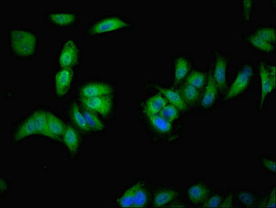 Immunofluorescent analysis of Hela cells using CSB-PA800218LA01HU at dilution of 1:100 and Alexa Fluor 488-congugated AffiniPure Goat Anti-Rabbit IgG(H+L)