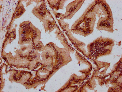 IHC image of CSB-PA809028LA01HU diluted at 1:800 and staining in paraffin-embedded human prostate tissue performed on a Leica BondTM system. After dewaxing and hydration, antigen retrieval was mediated by high pressure in a citrate buffer (pH 6.0). Section was blocked with 10% normal goat serum 30min at RT. Then primary antibody (1% BSA) was incubated at 4°C overnight. The primary is detected by a biotinylated secondary antibody and visualized using an HRP conjugated SP system.