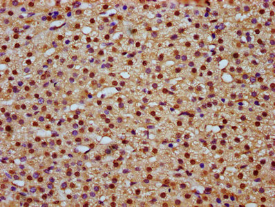 IHC image of CSB-PA809028LA01HU diluted at 1:800 and staining in paraffin-embedded human adrenal gland tissue performed on a Leica BondTM system. After dewaxing and hydration, antigen retrieval was mediated by high pressure in a citrate buffer (pH 6.0). Section was blocked with 10% normal goat serum 30min at RT. Then primary antibody (1% BSA) was incubated at 4°C overnight. The primary is detected by a biotinylated secondary antibody and visualized using an HRP conjugated SP system.