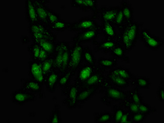 Immunofluorescence staining of Hela cells with CSB-PA815541LA01HU at 1:100, counter-stained with DAPI. The cells were fixed in 4% formaldehyde, permeabilized using 0.2% Triton X-100 and blocked in 10% normal Goat Serum. The cells were then incubated with the antibody overnight at 4°C. The secondary antibody was Alexa Fluor 488-congugated AffiniPure Goat Anti-Rabbit IgG(H+L).