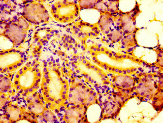 IHC image of CSB-PA815541LA01HU diluted at 1:100 and staining in paraffin-embedded human salivary gland tissue performed on a Leica BondTM system. After dewaxing and hydration, antigen retrieval was mediated by high pressure in a citrate buffer (pH 6.0). Section was blocked with 10% normal goat serum 30min at RT. Then primary antibody (1% BSA) was incubated at 4°C overnight. The primary is detected by a biotinylated secondary antibody and visualized using an HRP conjugated SP system.