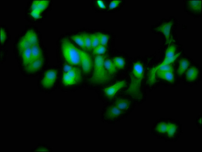 Immunofluorescence staining of MCF-7 cells with CSB-PA822207LA01HU at 1:100, counter-stained with DAPI. The cells were fixed in 4% formaldehyde, permeabilized using 0.2% Triton X-100 and blocked in 10% normal Goat Serum. The cells were then incubated with the antibody overnight at 4°C. The secondary antibody was Alexa Fluor 488-congugated AffiniPure Goat Anti-Rabbit IgG(H+L).