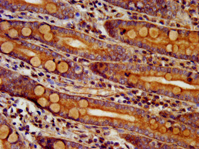 IHC image of CSB-PA822207LA01HU diluted at 1:300 and staining in paraffin-embedded human small intestine tissue performed on a Leica BondTM system. After dewaxing and hydration, antigen retrieval was mediated by high pressure in a citrate buffer (pH 6.0). Section was blocked with 10% normal goat serum 30min at RT. Then primary antibody (1% BSA) was incubated at 4°C overnight. The primary is detected by a biotinylated secondary antibody and visualized using an HRP conjugated SP system.