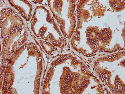 IHC image of CSB-PA823456LA01HU diluted at 1:300 and staining in paraffin-embedded human prostate tissue performed on a Leica BondTM system. After dewaxing and hydration, antigen retrieval was mediated by high pressure in a citrate buffer (pH 6.0). Section was blocked with 10% normal goat serum 30min at RT. Then primary antibody (1% BSA) was incubated at 4°C overnight. The primary is detected by a biotinylated secondary antibody and visualized using an HRP conjugated SP system.