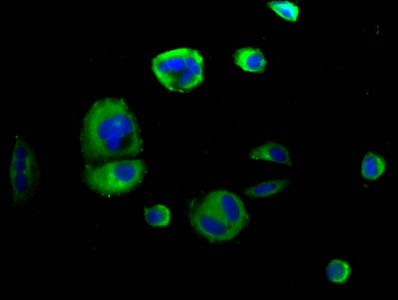 Immunofluorescence(IF) - SEMA4D Antibody