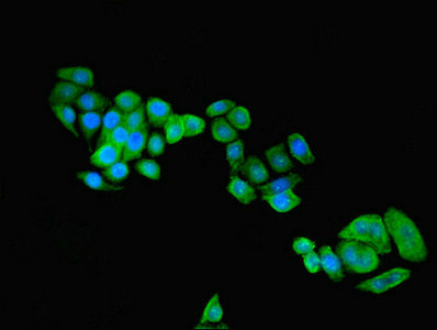 Immunofluorescence(IF) - C9orf72 Antibody