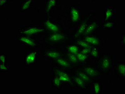 Immunofluorescence staining of Hela cells with CSB-PA846106LA01HU at 1:100, counter-stained with DAPI. The cells were fixed in 4% formaldehyde, permeabilized using 0.2% Triton X-100 and blocked in 10% normal Goat Serum. The cells were then incubated with the antibody overnight at 4°C. The secondary antibody was Alexa Fluor 488-congugated AffiniPure Goat Anti-Rabbit IgG(H+L).