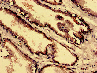 Immunohistochemistry analysis of human prostate tissue using CSB-PA850253LA01HU at dilution of 1:100