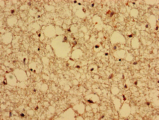 Immunohistochemistry analysis of human brain tissue using CSB-PA850253LA01HU at dilution of 1:100