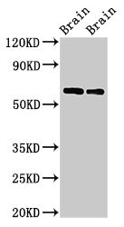 Western Blot Positive WB detected in: Rat brain tissue, Mouse brain tissue All lanes: CPNE4 antibody at 2ug/ml Secondary Goat polyclonal to rabbit IgG at 1/50000 dilution Predicted band size: 63, 65 kDa Observed band size: 63 kDa Western Blot Positive WB detected in: Rat brain tissue, Mouse brain tissue All lanes: CPNE4 antibody at 2ug/ml Secondary Goat polyclonal to rabbit IgG at 1/50000 dilution Predicted band size: 63, 65 kDa Observed band size: 63 kDa