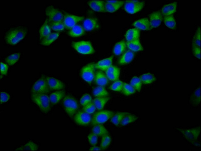 Immunofluorescence staining of Hela cells with CSB-PA850415LA01HU at 1:133, counter-stained with DAPI. The cells were fixed in 4% formaldehyde, permeabilized using 0.2% Triton X-100 and blocked in 10% normal Goat Serum. The cells were then incubated with the antibody overnight at 4°C. The secondary antibody was Alexa Fluor 488-congugated AffiniPure Goat Anti-Rabbit IgG(H+L).