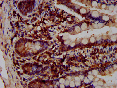 IHC image of CSB-PA850779LA01HU diluted at 1:200 and staining in paraffin-embedded human small intestine tissue performed on a Leica BondTM system. After dewaxing and hydration, antigen retrieval was mediated by high pressure in a citrate buffer (pH 6.0). Section was blocked with 10% normal goat serum 30min at RT. Then primary antibody (1% BSA) was incubated at 4°C overnight. The primary is detected by a biotinylated secondary antibody and visualized using an HRP conjugated SP system. IHC image of CSB-PA850779LA01HU diluted at 1:200 and staining in paraffin-embedded human small intestine tissue performed on a Leica BondTM system. After dewaxing and hydration, antigen retrieval was mediated by high pressure in a citrate buffer (pH 6.0). Section was blocked with 10% normal goat serum 30min at RT. Then primary antibody (1% BSA) was incubated at 4°C overnight. The primary is detected by a biotinylated secondary antibody and visualized using an HRP conjugated SP system.