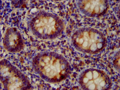 IHC image of CSB-PA850779LA01HU diluted at 1:200 and staining in paraffin-embedded human appendix tissue performed on a Leica BondTM system. After dewaxing and hydration, antigen retrieval was mediated by high pressure in a citrate buffer (pH 6.0). Section was blocked with 10% normal goat serum 30min at RT. Then primary antibody (1% BSA) was incubated at 4°C overnight. The primary is detected by a biotinylated secondary antibody and visualized using an HRP conjugated SP system.