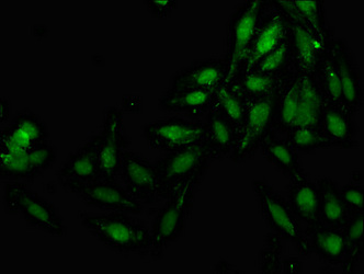 Immunofluorescence staining of Hela cells with CSB-PA850838LA01HU at 1:133, counter-stained with DAPI. The cells were fixed in 4% formaldehyde, permeabilized using 0.2% Triton X-100 and blocked in 10% normal Goat Serum. The cells were then incubated with the antibody overnight at 4°C. The secondary antibody was Alexa Fluor 488-congugated AffiniPure Goat Anti-Rabbit IgG(H+L).