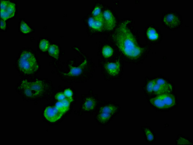Immunofluorescence staining of MCF-7 cells with CSB-PA854026LA01HU at 1:166, counter-stained with DAPI. The cells were fixed in 4% formaldehyde, permeabilized using 0.2% Triton X-100 and blocked in 10% normal Goat Serum. The cells were then incubated with the antibody overnight at 4°C. The secondary antibody was Alexa Fluor 488-congugated AffiniPure Goat Anti-Rabbit IgG(H+L).