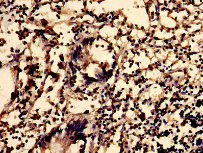 IHC image of CSB-PA854159LA01HU diluted at 1:600 and staining in paraffin-embedded human appendix tissue performed on a Leica BondTM system. After dewaxing and hydration, antigen retrieval was mediated by high pressure in a citrate buffer (pH 6.0). Section was blocked with 10% normal goat serum 30min at RT. Then primary antibody (1% BSA) was incubated at 4°C overnight. The primary is detected by a biotinylated secondary antibody and visualized using an HRP conjugated SP system.