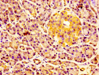 IHC image of CSB-PA857020EA01HU diluted at 1:100 and staining in paraffin-embedded human pancreatic tissue performed on a Leica BondTM system. After dewaxing and hydration, antigen retrieval was mediated by high pressure in a citrate buffer (pH 6.0). Section was blocked with 10% normal goat serum 30min at RT. Then primary antibody (1% BSA) was incubated at 4°C overnight. The primary is detected by a biotinylated secondary antibody and visualized using an HRP conjugated SP system.