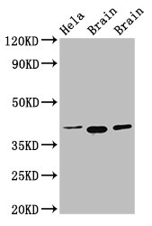 Western Blot Positive WB detected in: Hela whole cell lysate, Rat brain tissue, Mouse brain tissue All lanes: ERGIC2 antibody at 2.5microg/ml Secondary Goat polyclonal to rabbit IgG at 1/50000 dilution Predicted band size: 43 kDa Observed band size: 43 kDa Western Blot Positive WB detected in: Hela whole cell lysate, Rat brain tissue, Mouse brain tissue All lanes: ERGIC2 antibody at 2.5microg/ml Secondary Goat polyclonal to rabbit IgG at 1/50000 dilution Predicted band size: 43 kDa Observed band size: 43 kDa