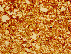 Immunohistochemistry of paraffin-embedded human brain tissue using CSB-PA859113EA01HU at dilution of 1:100
