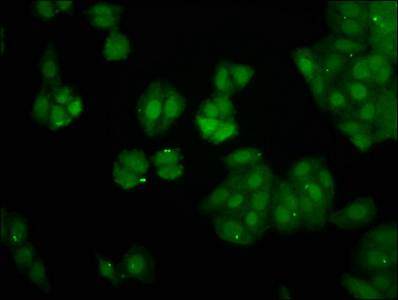 Immunofluorescence staining of HepG2 cells with CSB-PA861478LA01HU at 1:266, counter-stained with DAPI. The cells were fixed in 4% formaldehyde, permeabilized using 0.2% Triton X-100 and blocked in 10% normal Goat Serum. The cells were then incubated with the antibody overnight at 4°C. The secondary antibody was Alexa Fluor 488-congugated AffiniPure Goat Anti-Rabbit IgG(H+L).