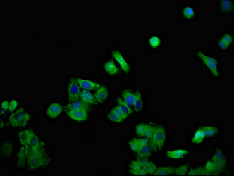Immunofluorescence(IF) - DSG1 Antibody