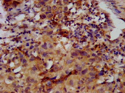 CSB-PA862050LA01HU IHC-1