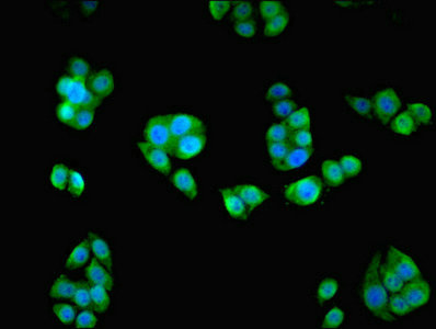 Immunofluorescent analysis of PC-3 cells using CSB-PA863116ESR1HU at dilution of 1:100 and Alexa Fluor 488-congugated AffiniPure Goat Anti-Rabbit IgG(H+L)