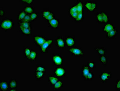 Immunofluorescent analysis of PC-3 cells using CSB-PA863116ESR2HU at dilution of 1:100 and Alexa Fluor 488-congugated AffiniPure Goat Anti-Rabbit IgG(H+L)