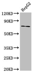 Western Blotting(WB) - ABCG5 Antibody