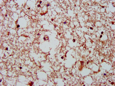 IHC image of CSB-PA872487LA01HU diluted at 1:400 and staining in paraffin-embedded human brain tissue performed on a Leica BondTM system. After dewaxing and hydration, antigen retrieval was mediated by high pressure in a citrate buffer (pH 6.0). Section was blocked with 10% normal goat serum 30min at RT. Then primary antibody (1% BSA) was incubated at 4°C overnight. The primary is detected by a biotinylated secondary antibody and visualized using an HRP conjugated SP system.