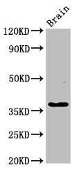 Western Blot Positive WB detected in: Rat brain tissue All lanes: GHITM antibody at 2.7microg/ml Secondary Goat polyclonal to rabbit IgG at 1/50000 dilution Predicted band size: 38 kDa Observed band size: 38 kDa