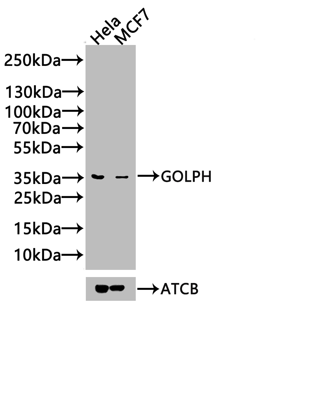 Western Blot Positive WB detected in: Hela whole cell lysate, 293 whole cell lysate, A549 whole cell lysate All lanes: GOLPH3 antibody at 3.2microg/ml Secondary Goat polyclonal to rabbit IgG at 1/50000 dilution Predicted band size: 34 kDa Observed band size: 34 kDa