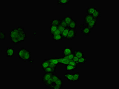 Immunofluorescent analysis of PC-3 cells using CSB-PA872547LA01HU at dilution of 1:100 and Alexa Fluor 488-congugated AffiniPure Goat Anti-Rabbit IgG(H+L)