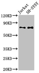 Western Blot Positive WB detected in: Jurkat whole cell lysate, SH-SY5Y whole cell lysate All lanes: RAVER2 antibody at 3microg/ml Secondary Goat polyclonal to rabbit IgG at 1/50000 dilution Predicted band size: 75, 73 kDa Observed band size: 75 kDa
