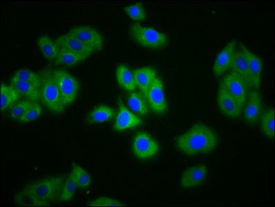 Immunofluorescence staining of HepG2 cells with CSB-PA874837LA01HU at 1:133, counter-stained with DAPI. The cells were fixed in 4% formaldehyde, permeabilized using 0.2% Triton X-100 and blocked in 10% normal Goat Serum. The cells were then incubated with the antibody overnight at 4°C. The secondary antibody was Alexa Fluor 488-congugated AffiniPure Goat Anti-Rabbit IgG(H+L).