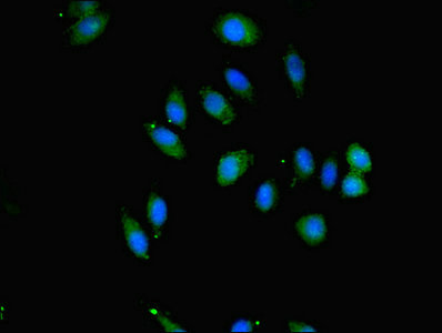 Immunofluorescent analysis of A549 cells using CSB-PA875672ESR2HU at dilution of 1:100 and Alexa Fluor 488-congugated AffiniPure Goat Anti-Rabbit IgG(H+L)