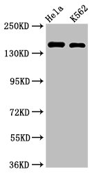 Western Blotting(WB) - CDK12 Antibody
