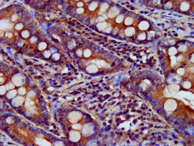 IHC image of CSB-PA890777LA01HU diluted at 1:200 and staining in paraffin-embedded human small intestine tissue performed on a Leica BondTM system. After dewaxing and hydration, antigen retrieval was mediated by high pressure in a citrate buffer (pH 6.0). Section was blocked with 10% normal goat serum 30min at RT. Then primary antibody (1% BSA) was incubated at 4°C overnight. The primary is detected by a biotinylated secondary antibody and visualized using an HRP conjugated SP system.