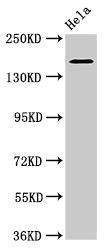 CSB-PA896760LA01HU