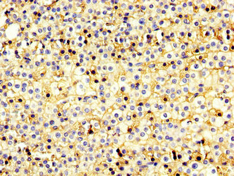 IHC image of CSB-PA896876LA01HU diluted at 1:200 and staining in paraffin-embedded human adrenal gland tissue performed on a Leica BondTM system. After dewaxing and hydration, antigen retrieval was mediated by high pressure in a citrate buffer (pH 6.0). Section was blocked with 10% normal goat serum 30min at RT. Then primary antibody (1% BSA) was incubated at 4°C overnight. The primary is detected by a biotinylated secondary antibody and visualized using an HRP conjugated SP system.