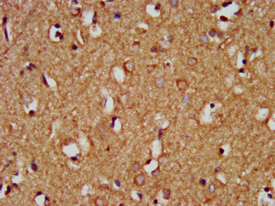 IHC image of CSB-PA896909LA01HU diluted at 1:200 and staining in paraffin-embedded human brain tissue performed on a Leica BondTM system. After dewaxing and hydration, antigen retrieval was mediated by high pressure in a citrate buffer (pH 6.0). Section was blocked with 10% normal goat serum 30min at RT. Then primary antibody (1% BSA) was incubated at 4°C overnight. The primary is detected by a biotinylated secondary antibody and visualized using an HRP conjugated SP system.