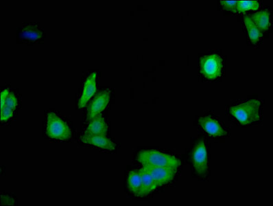 Immunofluorescence(IF) - LDHA Antibody