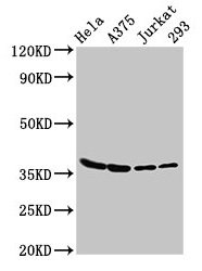 Western Blotting(WB) 3- LDHA Antibody