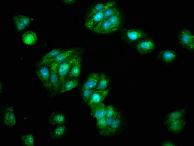 Immunofluorescence staining of HepG2 cells with CSB-PA001577LA01HU at 1:133, counter-stained with DAPI. The cells were fixed in 4% formaldehyde, permeabilized using 0.2% Triton X-100 and blocked in 10% normal Goat Serum. The cells were then incubated with the antibody overnight at 4°C. The secondary antibody was Alexa Fluor 488-congugated AffiniPure Goat Anti-Rabbit IgG(H+L).