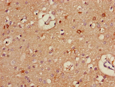 Immunohistochemistry of paraffin-embedded human brain tissue using CSB-PA001577LA01HU at dilution of 1:100