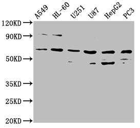 Western Blot Positive WB detected in: A549 whole cell lysate, HL60 whole cell lysate, U251 whole cell lysate, U87 whole cell lysate, HepG2 whole cell lysate, PC-3 whole cell lysate All lanes: AOAH antibody at 1:2000 Secondary Goat polyclonal to rabbit IgG at 1/50000 dilution Predicted band size: 66, 62 kDa Observed band size: 66 kDa