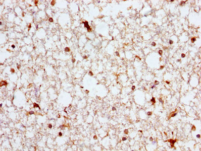 CSB-PA002226HA01HU