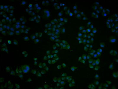 Immunofluorescence staining of Hela cells with CSB-PA002272LA01HU at 1:100, counter-stained with DAPI. The cells were fixed in 4% formaldehyde and blocked in 10% normal Goat Serum. The cells were then incubated with the antibody overnight at 4°C. The secondary antibody was Alexa Fluor 488-congugated AffiniPure Goat Anti-Rabbit IgG(H+L).