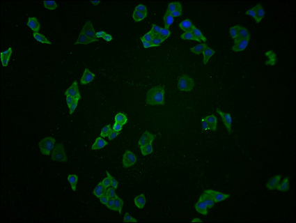 Immunofluorescence staining of Hela cells with CSB-PA002531LA01HU at 1:100, counter-stained with DAPI. The cells were fixed in 4% formaldehyde, permeabilized using 0.2% Triton X-100 and blocked in 10% normal Goat Serum. The cells were then incubated with the antibody overnight at 4°C. The secondary antibody was Alexa Fluor 488-congugated AffiniPure Goat Anti-Rabbit IgG(H+L).
