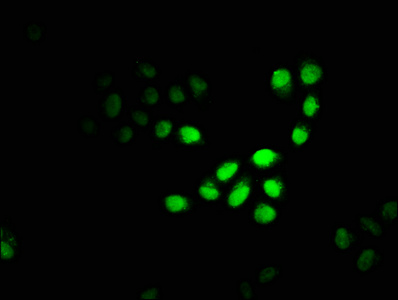 Immunofluorescence staining of Hela cells with CSB-PA004600EA01HU at 1:100, counter-stained with DAPI. The cells were fixed in 4% formaldehyde, permeabilized using 0.2% Triton X-100 and blocked in 10% normal Goat Serum. The cells were then incubated with the antibody overnight at 4°C. The secondary antibody was Alexa Fluor 488-congugated AffiniPure Goat Anti-Rabbit IgG(H+L).